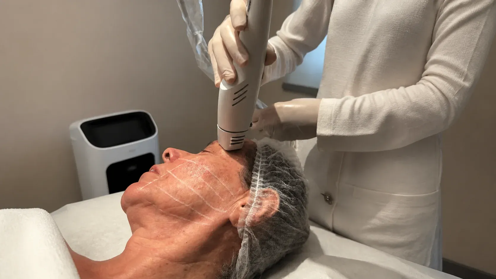 Aplicação do Coolfase durante procedimento dermatológico